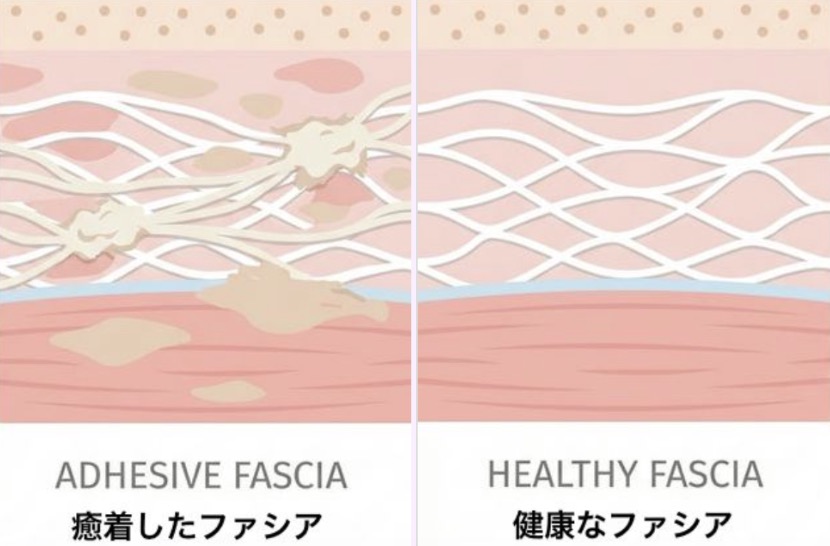 ファシアの比較イラスト