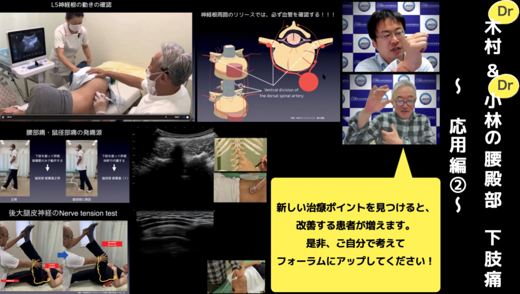 第45回JNOSウェブセミナー